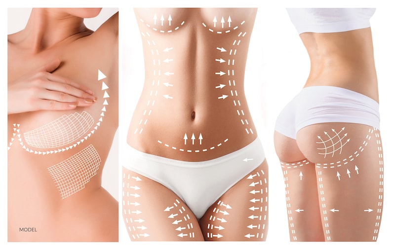 Models shown with white arrows drawn on to show the possibilities of plastic surgery,